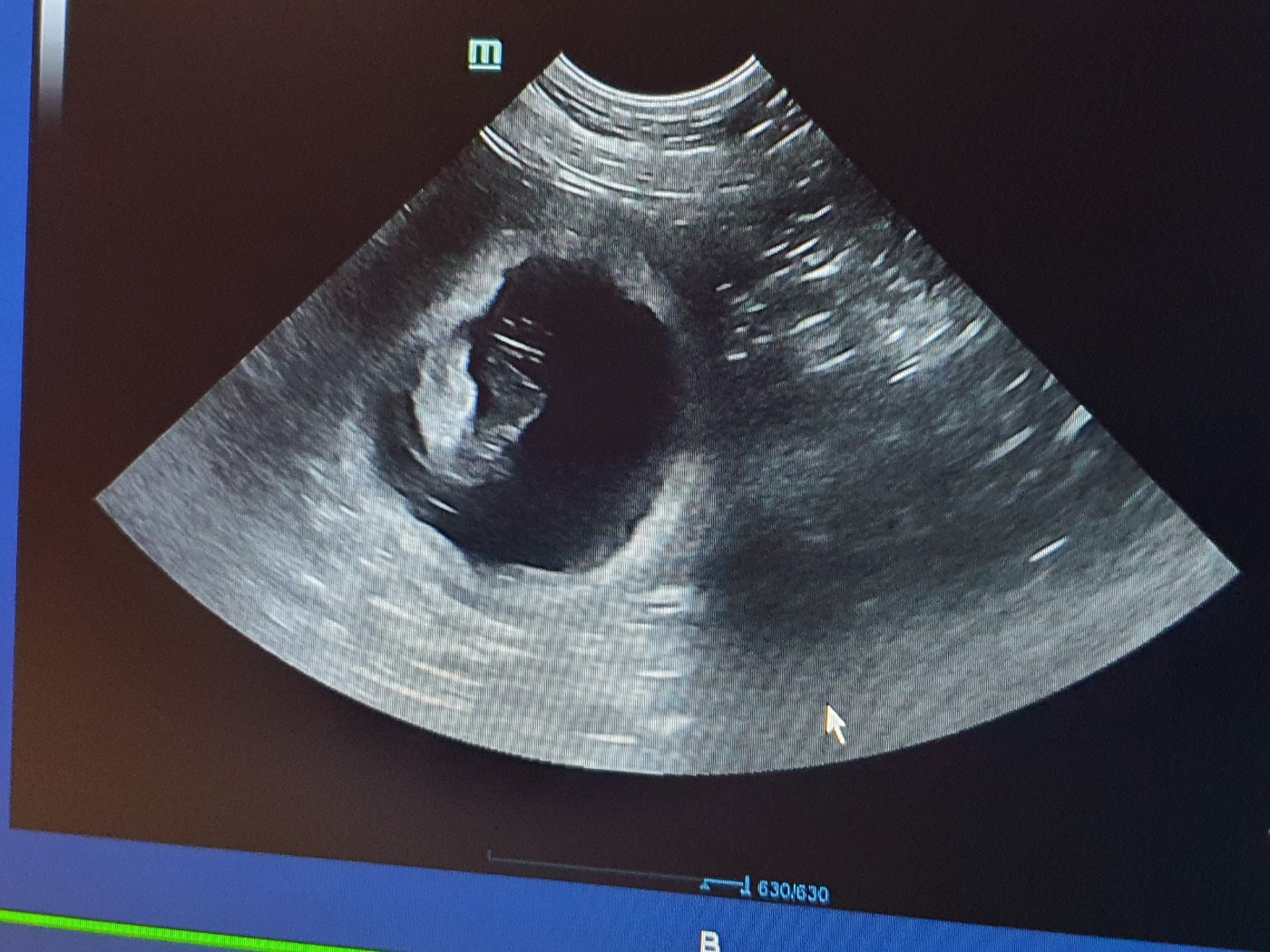 Bientôt les bébés de sexy lady et schnaps